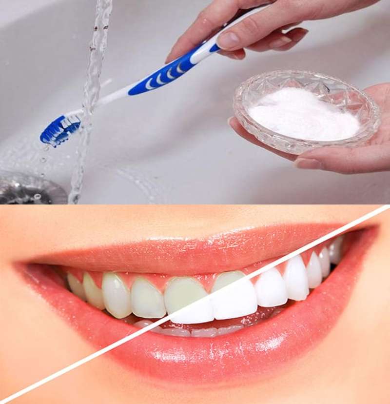 Revealing Easy at-Home Teeth Whitening Tips with Kitchen Ingredients